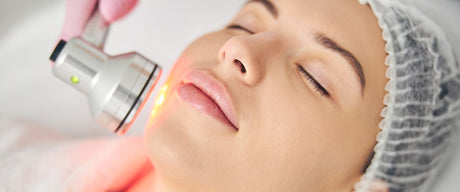 Phototherapy for Acne and Wrinkles