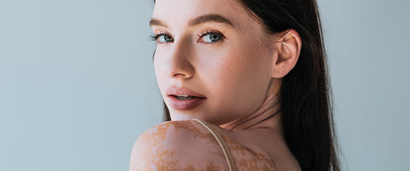 What does it mean to have uneven skin tone?