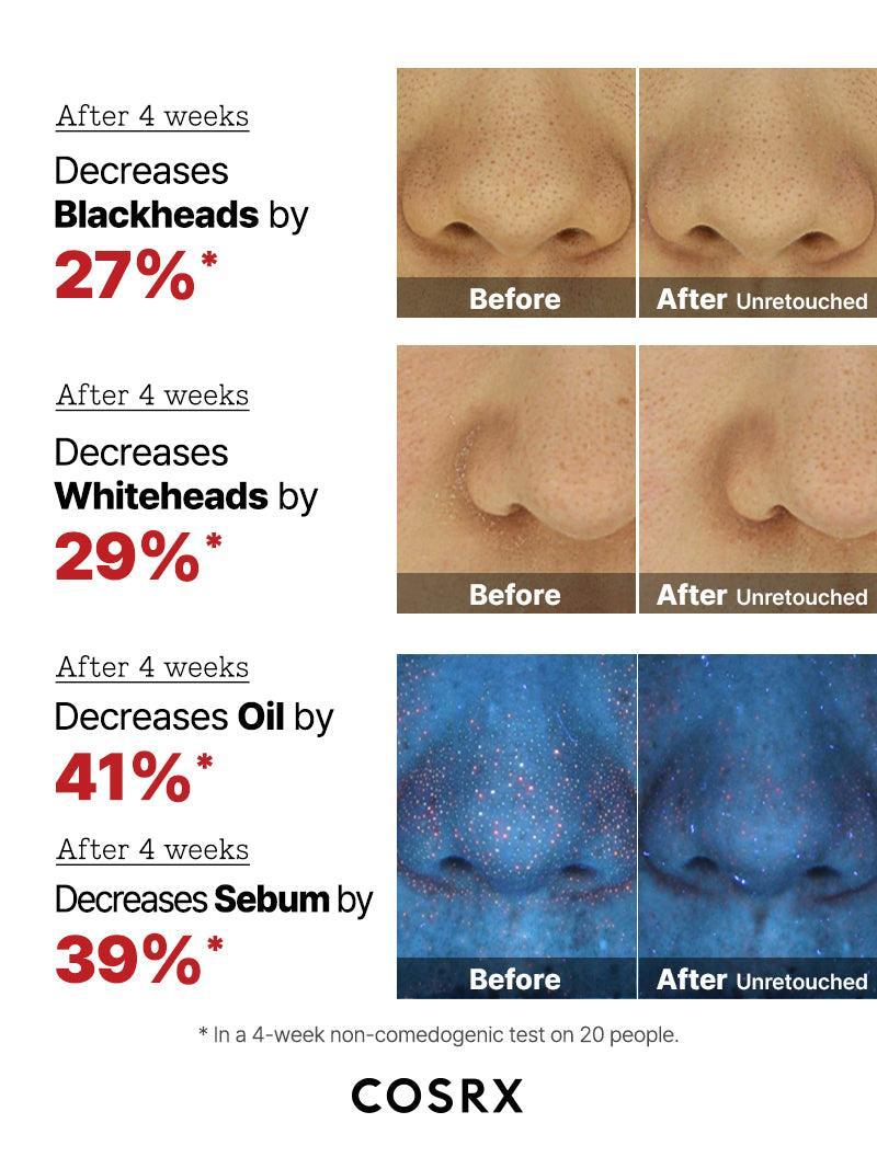 The AHA 2 BHA 2 Blemish Treatment