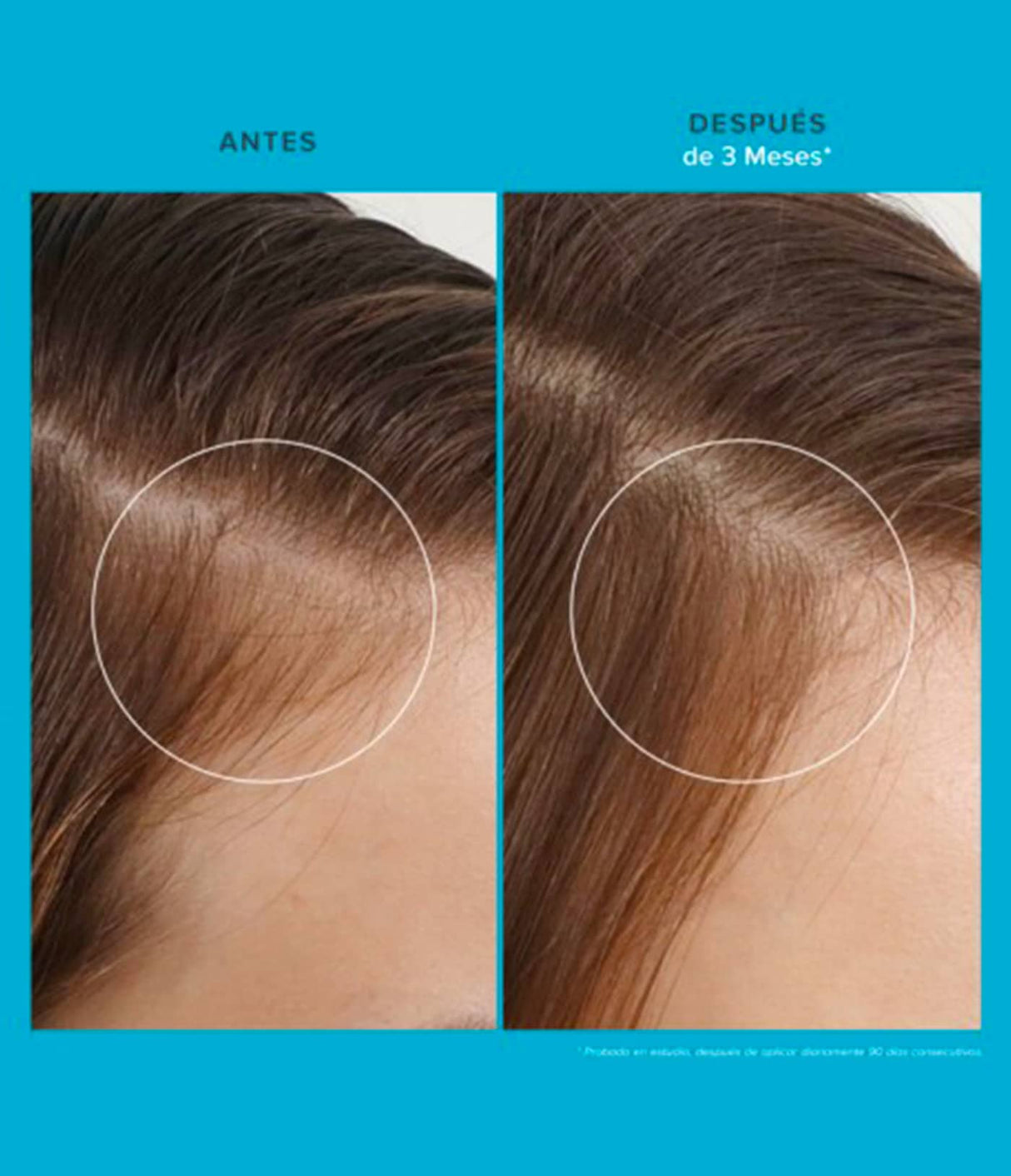 Living Proof Scalp Care Revitalizing Treatment