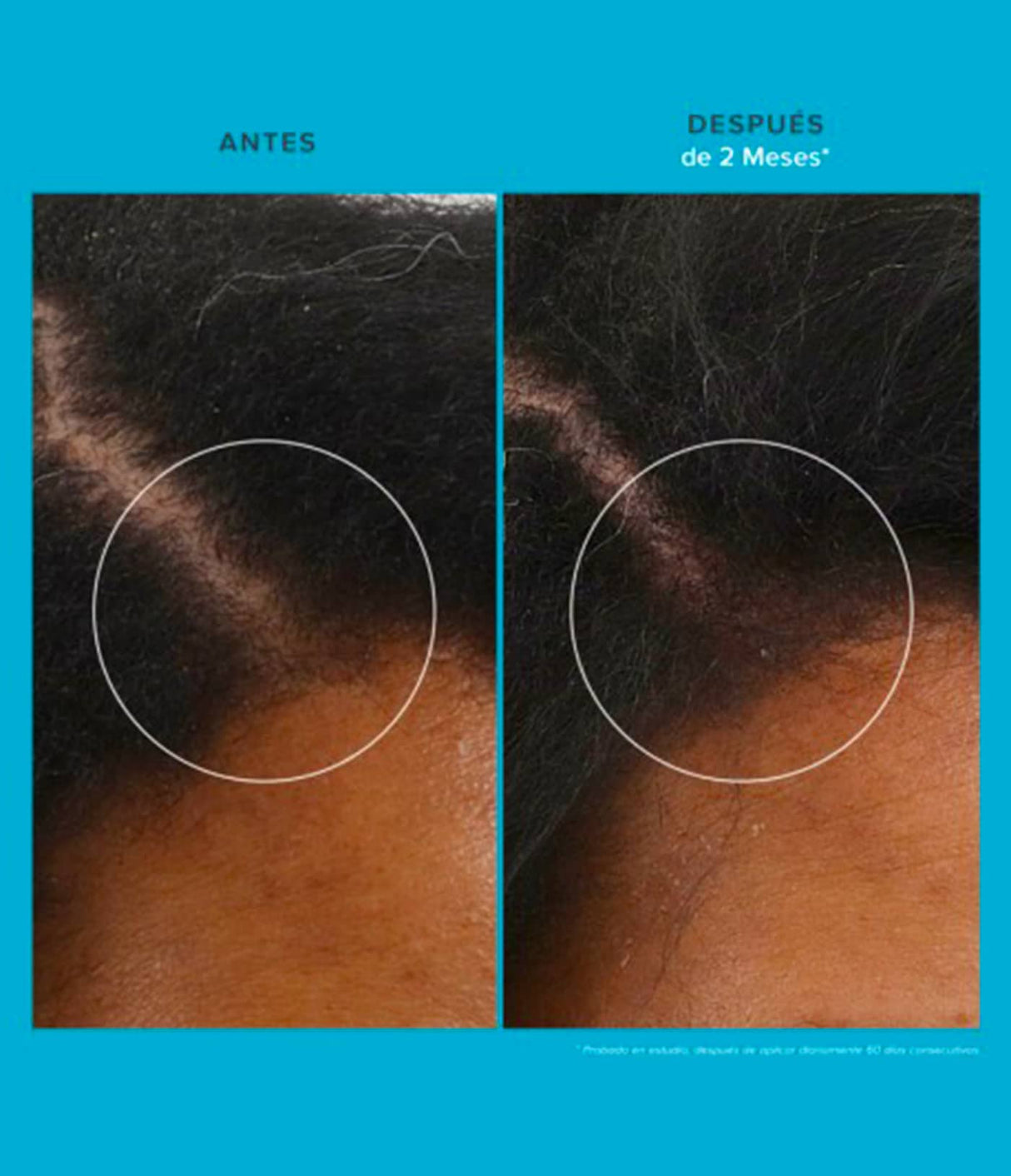 Living Proof Scalp Care Revitalizing Treatment